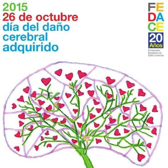 Imagen O Castelo iluminarase de verde esta noite en apoio ao Día do Dano Cerebral e do Ictus